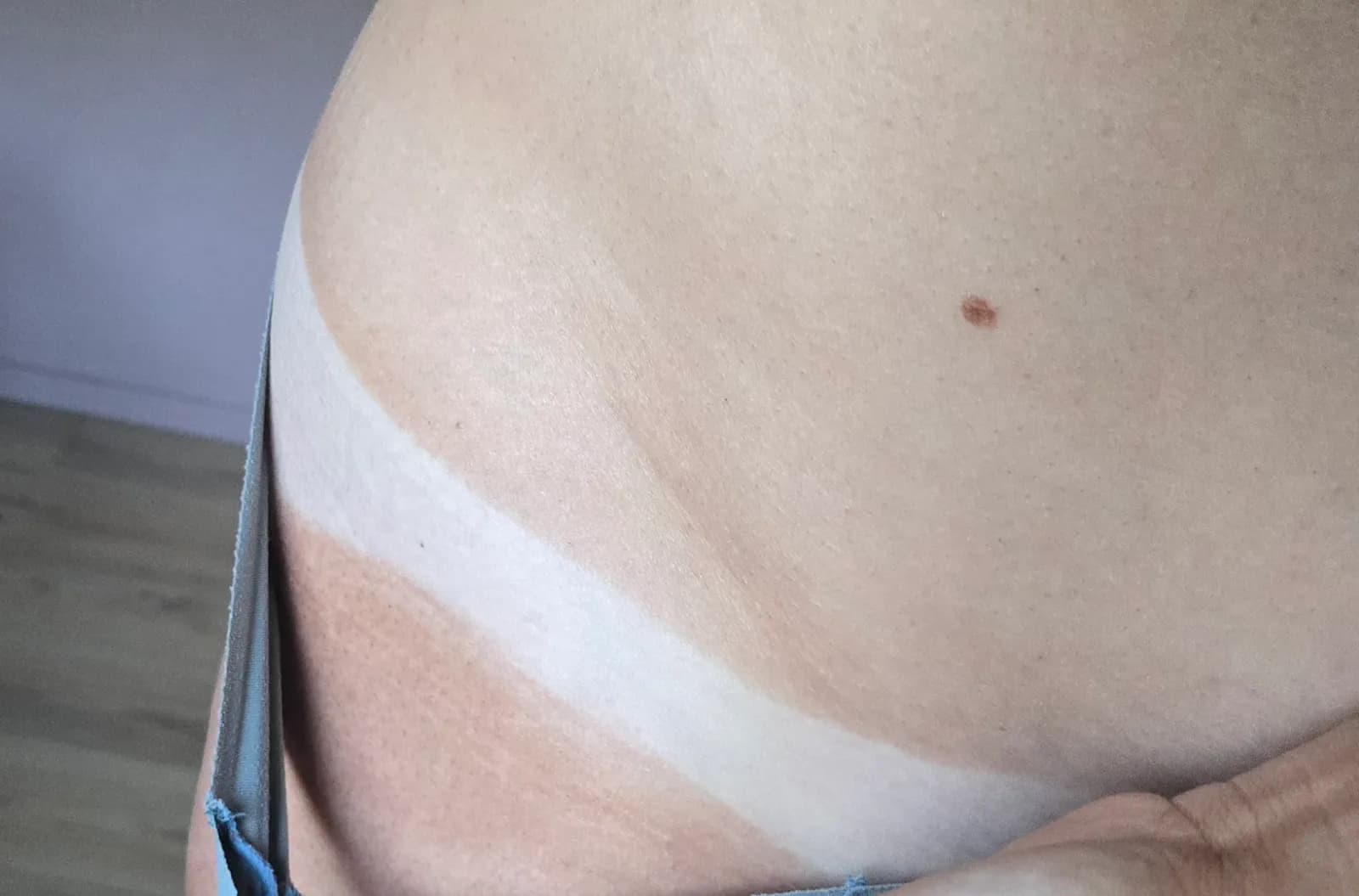 Natuurlijk spraytan-resultaat met duidelijke tanlijn bij daglicht